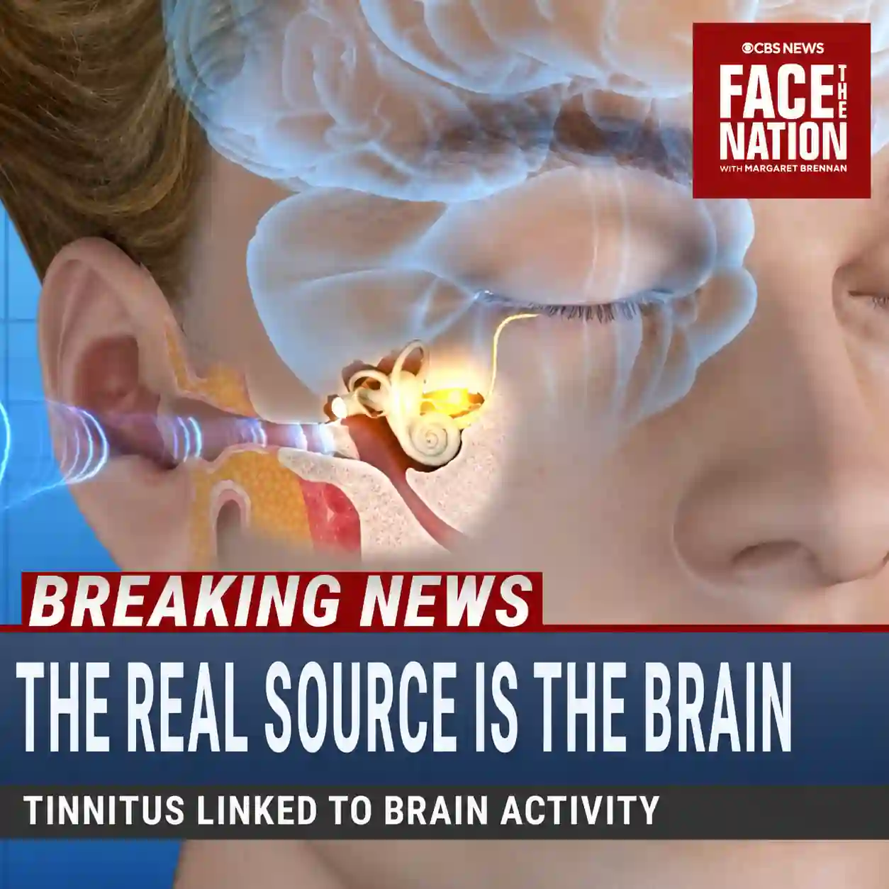 Tinnitus treatment discovery explained